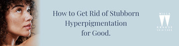 How to Get Rid of Stubborn Hyperpigmentation for Good