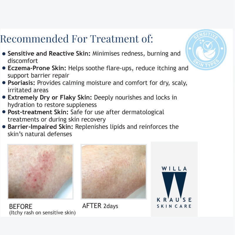 Willa Krause Sensitive Skin - Body Cream 200ml – image 5