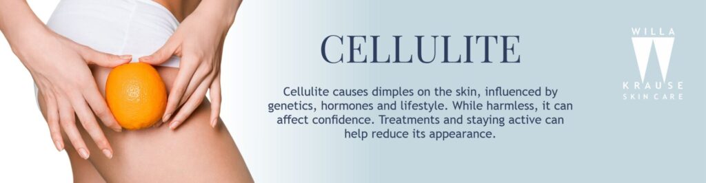 2024 BLOG Banner Cellulite | Skin Care